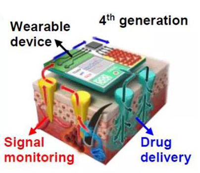 第四代透皮给药技术：在可穿戴设备的帮助下，用于患者定制治疗.jpg